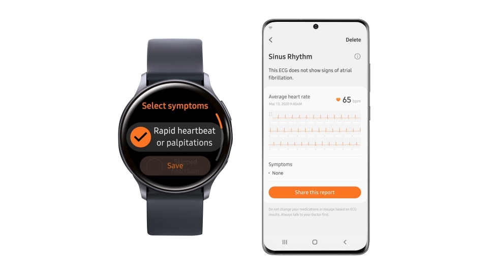 삼성전자가 식품의약품안전처로부터 심전도(ECG) 측정 앱 허가를 받았다.        삼성 헬스 모니터 앱과 갤럭시 워치 액티브2를 통해 심전도를 측정, 확인할 수 있다.